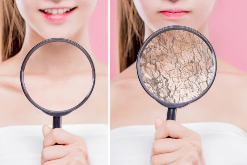 Không phải làn da nào cũng hợp dầu dừa, vì mỗi loại da có nhu cầu và mức độ nhạy cảm khác nhau.